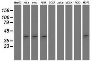 Image no. 2 for anti-SET Domain Containing (Lysine Methyltransferase) 7 (SETD7) antibody (ABIN1500903)