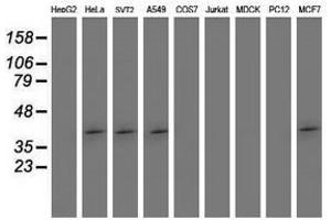 Image no. 2 for anti-SET Domain Containing (Lysine Methyltransferase) 7 (SETD7) antibody (ABIN1500903) (SETD7 anticorps)