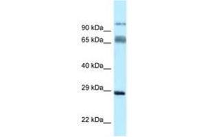 Image no. 1 for anti-Proline Rich Transmembrane Protein 1 (PRRT1) (N-Term) antibody (ABIN6747874)