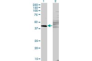 Western Blot analysis of ZNF193 expression in transfected 293T cell line by ZNF193 monoclonal antibody (M06), clone 3G6. (Zinc Finger and SCAN Domain Containing 9 (ZSCAN9) (AA 1-90) anticorps)