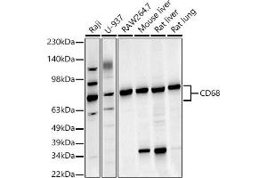 Western blot analysis of extracts of various cell lines, using CD68 antibody (ABIN6132070, ABIN6138218, ABIN6138221 and ABIN6217224) at 1:1000 dilution.