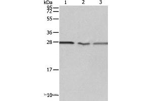 Western blot analysis of Jurkat, A549 cell and Human fetal kidney tissue, using PSMD9 Polyclonal Antibody at dilution of 1:750 (PSMD9 anticorps)