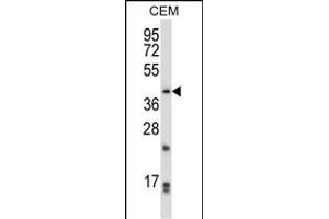 PITX2 Antibody (N-term) (ABIN657942 and ABIN2846886) western blot analysis in CEM cell line lysates (35 μg/lane).