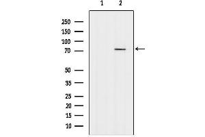 anti-Transforming Growth Factor beta Regulator 4 (TBRG4) (C-Term) antibody