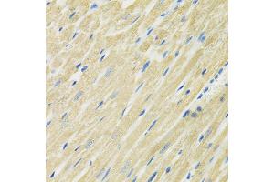 Immunohistochemistry of paraffin-embedded rat heart using SLC19A1 antibody (ABIN6291462) at dilution of 1:100 (40x lens).