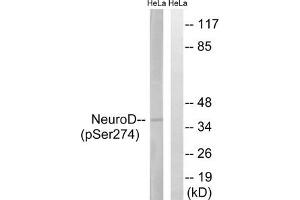 Western blot analysis of extracts from HeLa cells treated with UV using Neuro D (Phospho-Ser274) Antibody. (NEUROD1 anticorps  (pSer274))
