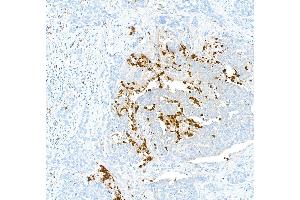 Immunohistochemistry (IHC) image for anti-S100 Calcium Binding Protein A9 (S100A9) (AA 64-114) antibody (ABIN7449432)