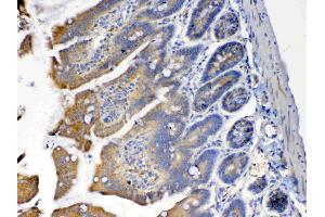 IHC analysis of PON1 using anti-PON1 antibody .