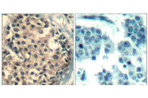 anti-HDAC4,HDAC5,HDAC9 (pSer220), (pSer246), (pSer259) antibody
