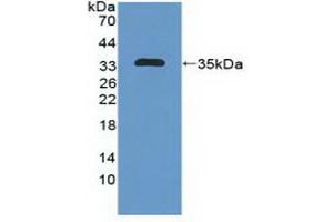 Detection of Recombinant MAP1B, Human using Polyclonal Antibody to Microtubule Associated Protein 1B (MAP1B) (MAP1B anticorps  (AA 2207-2468))