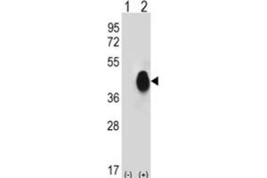 Western Blotting (WB) image for anti-CD38 antibody (ABIN3001687) (CD38 anticorps)