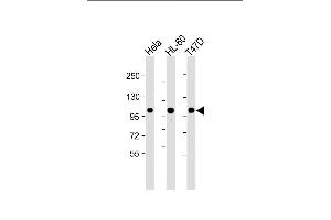 All lanes : Anti-EZH2 Antibody at 1:2000 dilution Lane 1: Hela whole cell lysate Lane 2: HL-60 whole cell lysate Lane 3: T47D whole cell lysate Lysates/proteins at 20 μg per lane. (EZH2 anticorps)