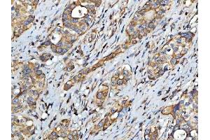 IHC analysis of FATP4/SLC27A4 using anti-FATP4/SLC27A4 antibody (ABIN7600117).