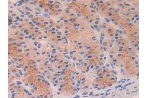 DAB staining on IHC-P; Samples: Rat Stomach Tissue (PFKP anticorps  (AA 354-570))