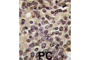 Immunohistochemistry (IHC) image for anti-PKN beta antibody (ABIN3003586) (PKN beta anticorps)