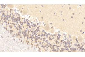 Detection of NOS1 in Rat Cerebellum Tissue using Polyclonal Antibody to Nitric Oxide Synthase 1, Neuronal (NOS1)