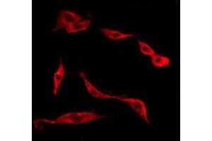 ABIN6277647 staining Hela by IF/ICC. (TACR1 anticorps  (Internal Region))