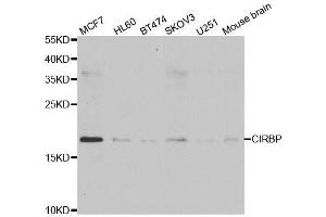 Western blot analysis of extracts of various cell lines, using CIRBP antibody. (CIRBP anticorps  (AA 1-172))
