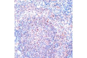 Immunohistochemistry of paraffin-embedded mouse spleen using RPS6K antibody (5718) at dilution of 1:100 (40x lens). (RPS6KA1 anticorps  (C-Term))