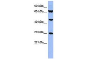 Image no. 1 for anti-Small Nuclear Ribonucleoprotein Polypeptides B and B1 (SNRPB) (AA 35-84) antibody (ABIN6742979) (SNRPB anticorps  (AA 35-84))