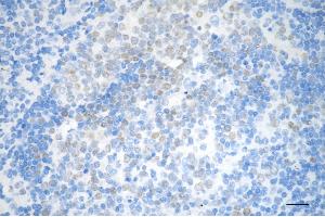 Immunohistochemistry was performed on paraffin-embedded human tonsillitis using DNA methyltransferase 1 antibody (ABIN7798362), 1:200). (Recombinant DNMT1 anticorps)
