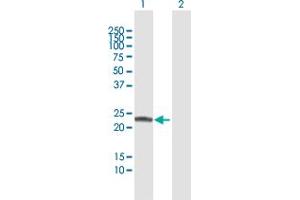 Western Blot analysis of COMT expression in transfected 293T cell line by COMT MaxPab polyclonal antibody. (COMT anticorps  (AA 1-221))