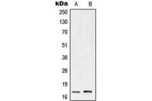 Western blot analysis of UBE2A/B expression in HeLa (A), Jurkat (B) whole cell lysates. (UBE2A/B (C-Term) anticorps)