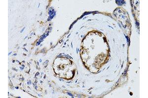 Immunohistochemistry of paraffin-embedded human placenta using RYR2 Antibody (ABIN5970123) at dilution of 1/100 (40x lens). (RYR2 anticorps)