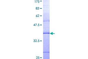 Image no. 1 for Myeloid Differentiation Primary Response Gene (88) (MYD88) (AA 31-130) protein (GST tag) (ABIN1311733)