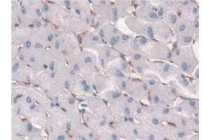 Detection of FcgRT in Human Liver Tissue using Polyclonal Antibody to Fc Fragment Of IgG Receptor Transporter Alpha (FcgRT)