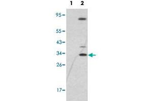 Western blot analysis of SNAI1 (arrow) using SNAI1 polyclonal antibody .