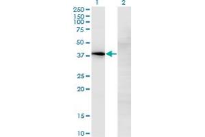 Western Blot analysis of NOV expression in transfected 293T cell line by NOV monoclonal antibody (M02), clone 2G8.