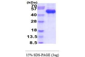 SDS-PAGE (SDS) image for Colony Stimulating Factor 2 Receptor, Alpha, Low-Affinity (Granulocyte-Macrophage) (CSF2RA) (AA 20-320) (Active) protein (His tag) (ABIN5855034) (CSF2RA Protein (AA 20-320) (His tag))