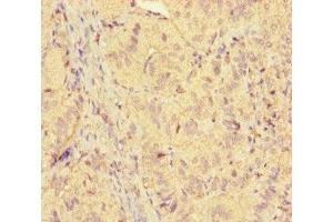 Immunohistochemistry of paraffin-embedded human adrenal gland tissue using ABIN7158468 at dilution of 1:100 (ICE1 (AA 1213-1505) anticorps)