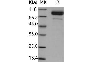 Coagulation Factor II (thrombin) (F2) (Active) protein (His tag)