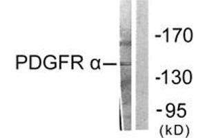 Western blot analysis of extracts from HepG2 cells, using PDGFR alpha Antibody. (PDGFRA anticorps  (AA 1031-1080))