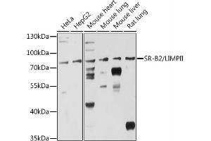 Western blot analysis of extracts of various cell lines, using SR-B2/LIMPII antibody (ABIN6127596, ABIN6147412, ABIN6147414 and ABIN6216462) at 1:3000 dilution. (SCARB2 anticorps  (AA 200-380))