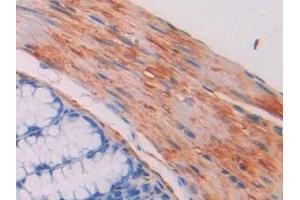 Detection of MYLK in Mouse Colon Tissue using Polyclonal Antibody to Myosin Light Chain Kinase (MYLK) (MYLK anticorps  (AA 1684-1884))