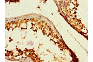 Immunohistochemistry of paraffin-embedded human testis tissue using ABIN7146159 at dilution of 1:100 (C2CD3 anticorps  (AA 2079-2265))
