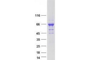 Validation with Western Blot