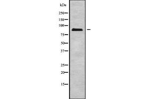 Western blot analysis of ERCC2 using A549 whole cell lysates (ERCC2 anticorps  (C-Term))