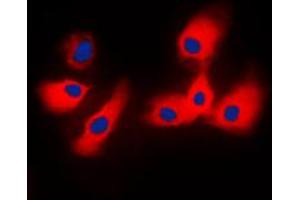 Immunofluorescent analysis of 14-3-3 epsilon staining in NIH3T3 cells. (YWHAE anticorps  (C-Term))