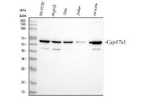 Western blot analysis of CYP17A1 using anti-CYP17A1 antibody (ABIN4886555).