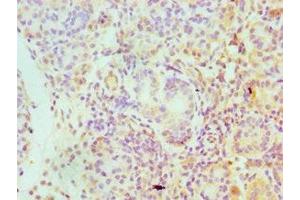Immunohistochemistry of paraffin-embedded human pancreatic tissue using ABIN7157225 at dilution of 1:100 (SERPINA4 anticorps  (AA 178-427))