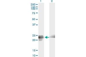 Western Blot analysis of BIN3 expression in transfected 293T cell line by BIN3 monoclonal antibody (M01A), clone 3G3. (BIN3 anticorps  (AA 1-199))