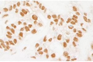 Immunohistochemistry (IHC) image for anti-RD RNA Binding Protein (RDBP) (AA 330-380) antibody (ABIN7454422)