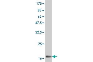 Western Blot detection against Immunogen (19.