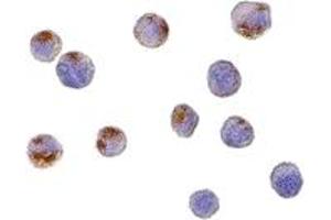 Immunohistochemistry (IHC) image for anti-Complement C1q Tumor Necrosis Factor-Related Protein 6 (C1QTNF6) (C-Term) antibody (ABIN1030348) (CTRP6 anticorps  (C-Term))