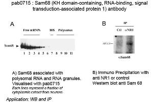 Image no. 1 for anti-KH Domain-Containing, RNA-Binding, Signal Transduction-Associated Protein (Sam68) antibody (ABIN559716) (KH Domain-Containing, RNA-Binding, Signal Transduction-Associated Protein (Sam68) anticorps)