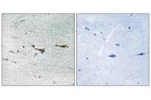Immunohistochemistry analysis of paraffin-embedded human brain tissue using TOB1 (Ab-164) antiobdy.